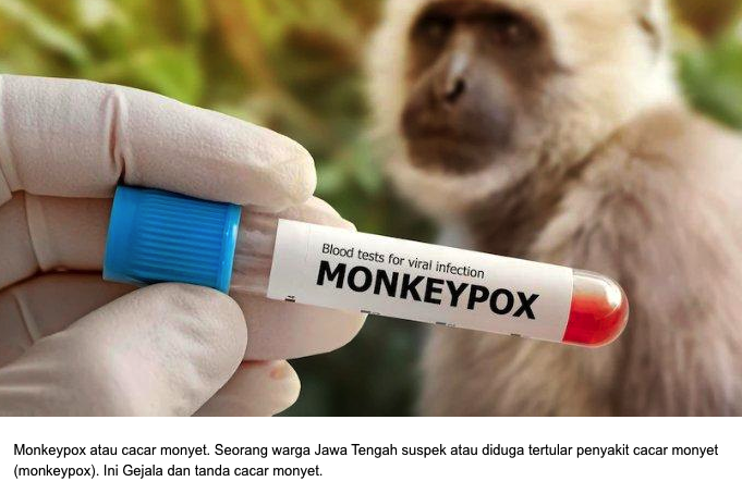 Cacar Monyet